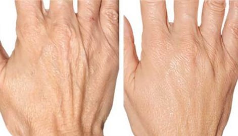 Why Your Hands Are Ugly And How To Treat It