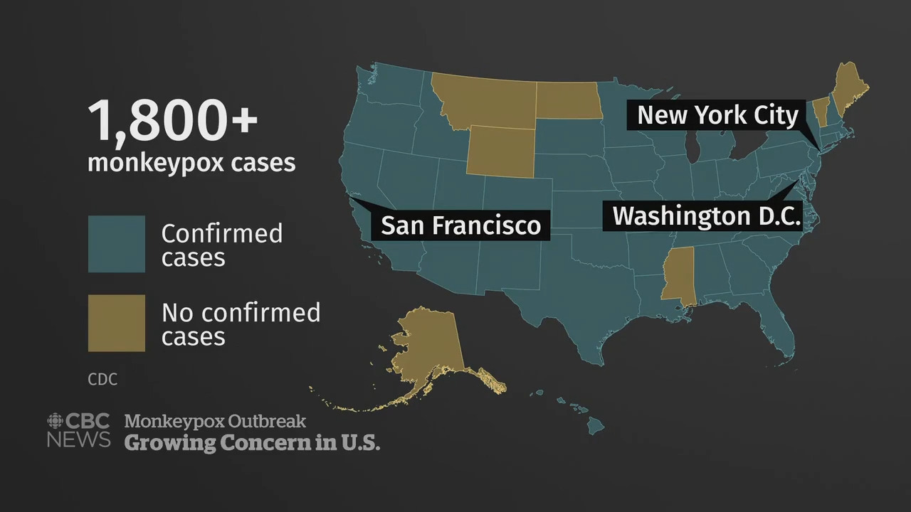 Monkeypox surge prompts growing demand for vaccine in U.S.