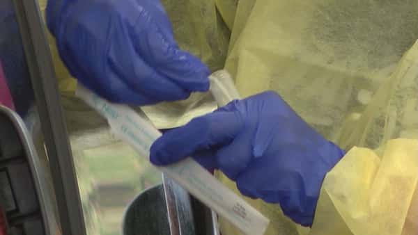 Alabama positivity rate increases amid record high numbers