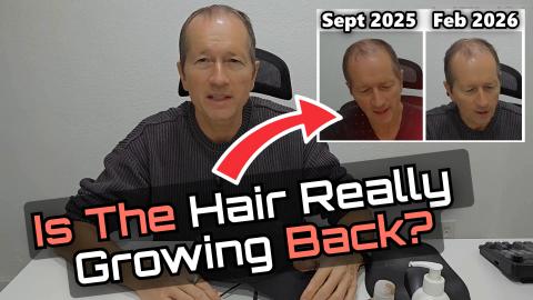 Is My Hair Really Growing Back? LumyHealth LED Cap Result...