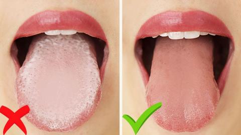 Why Your Tongue Is White