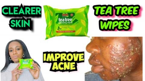 Tea Tree Facial Wipes From Beauty Formulas, Review. Remov...
