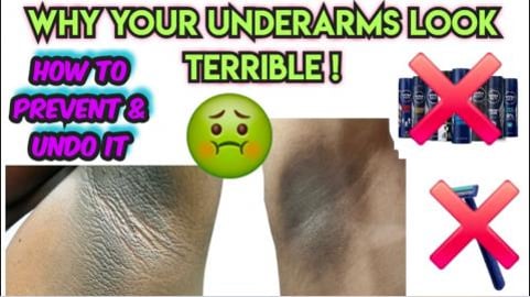 Why Your Armpits/ Underarms Look This Way, Black Underarm...