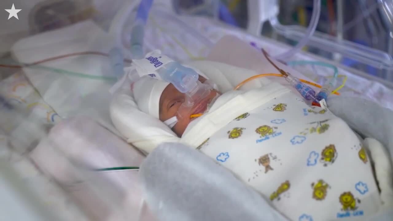 Mother gives birth to rare triplet girls at Kansas City hospital