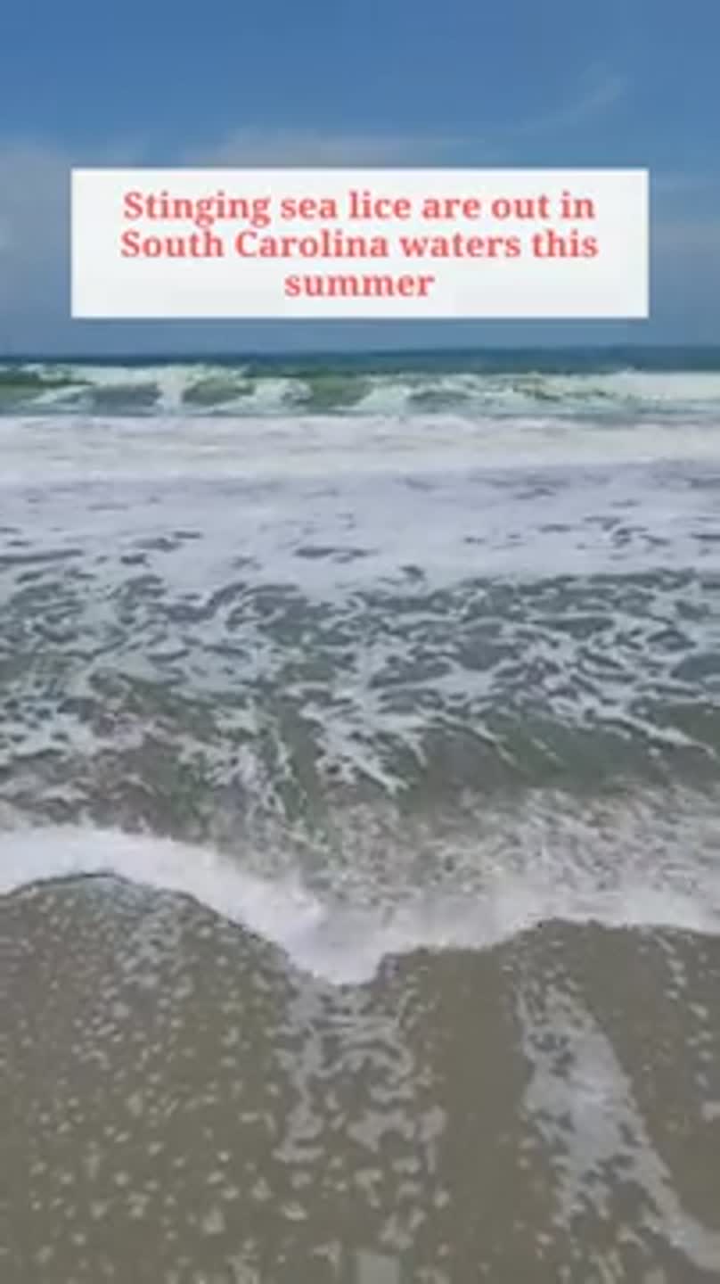 How to treat sea lice rashes | Myrtle Beach Sun News