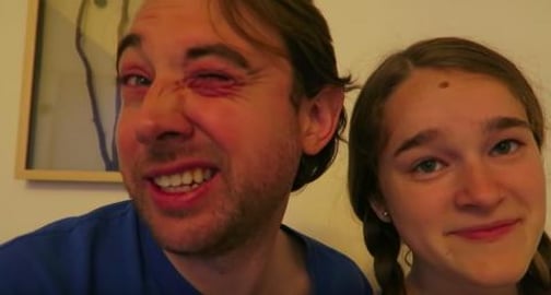 BAD ALLERGIC REACTION! (China Day 5)