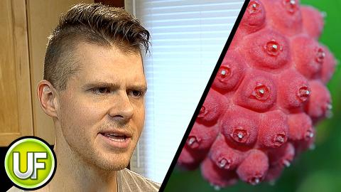 Unusual Foods - Kousa Dogwood