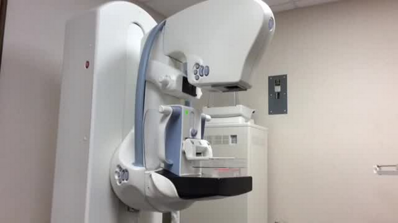 VIDEO 3D mammography at Cypress Imaging Wichita Eagle