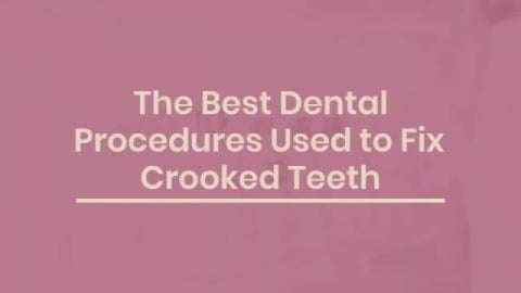 The Best Dental Procedures Used to Fix Crooked Teeth