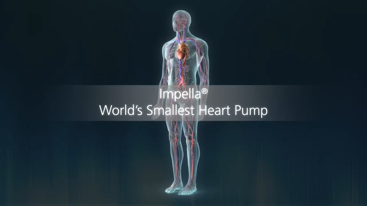 Watch video How does Impella mini heart pump work? Modesto Bee