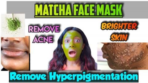 Remove Wrinkles, Acne, Dark Spots, Hyperpigmentation With...