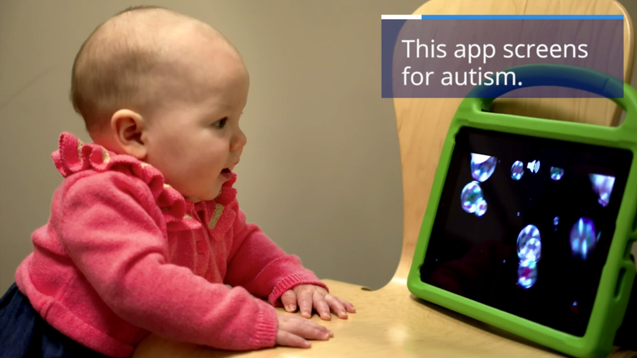 Duke team develops app to screen for autism in children | Durham Herald Sun