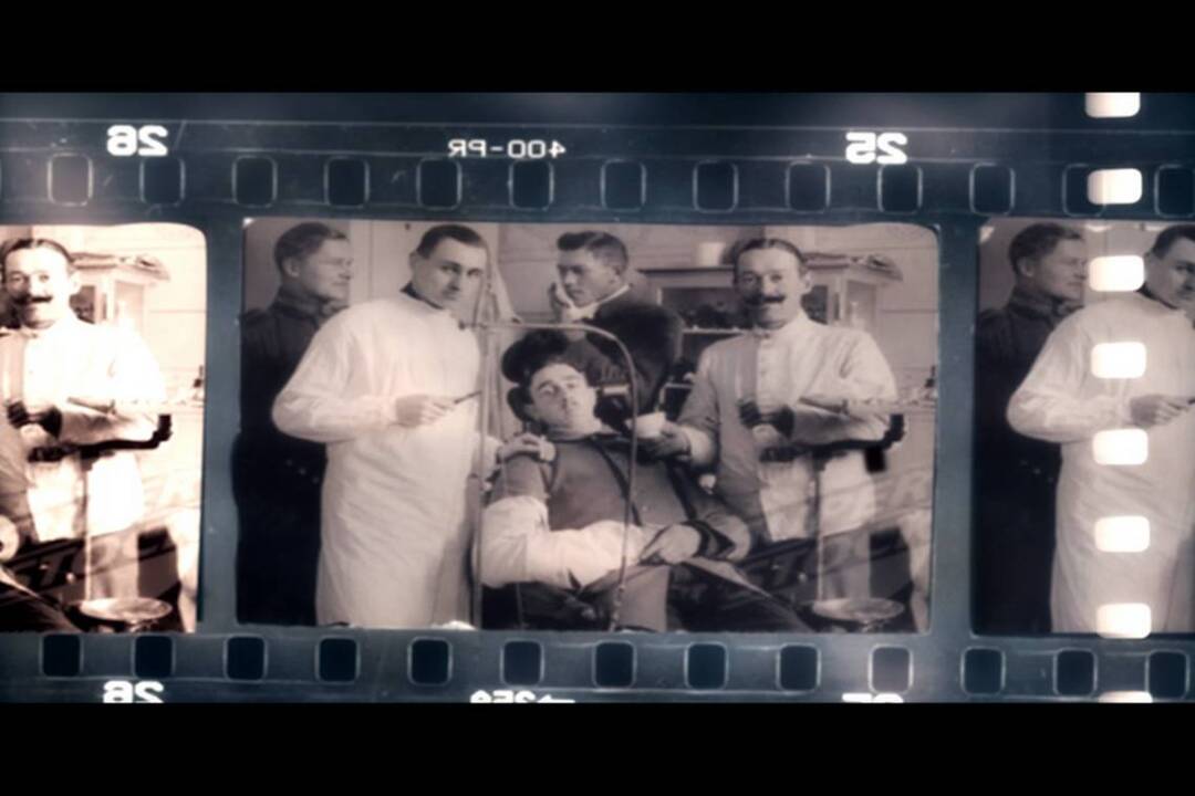 The history of dental amalgam McClatchy Washington Bureau