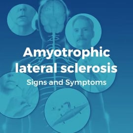 Amyotrophic lateral sclerosis_ Signs and Symptoms